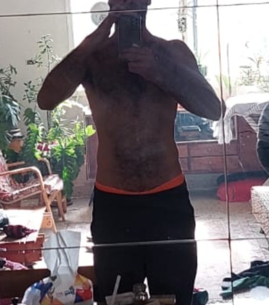 Client after six months of training, showing improved posture and more balanced support around the spine and pelvis.